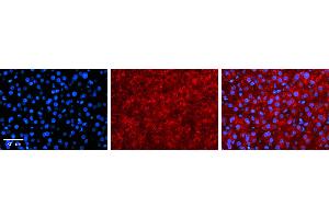 Immunohistochemistry (IHC) image for anti-Sulfotransferase Family, Cytosolic, 1A, Phenol-Preferring, Member 1 (SULT1A1) (N-Term) antibody (ABIN2783656)