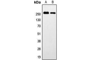 Western blot analysis of GPR179 expression in HeLa (A), SP2/0 (B) whole cell lysates. (GPR179 anticorps  (Center))