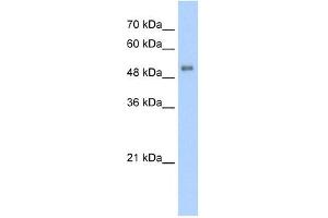 ALAS2 antibody used at 5 ug/ml to detect target protein.