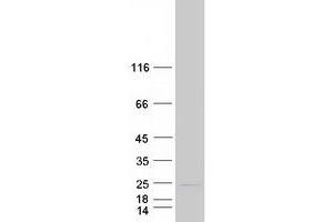 Validation with Western Blot