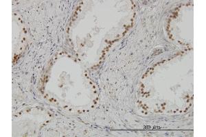 Immunoperoxidase of monoclonal antibody to CLK3 on formalin-fixed paraffin-embedded human prostate. (CLK3 anticorps  (AA 36-136))