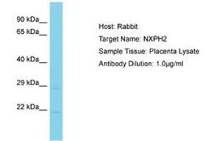 Image no. 1 for anti-Neurexophilin 2 (NXPH2) (AA 161-210) antibody (ABIN6750586) (NXPH2 anticorps  (AA 161-210))