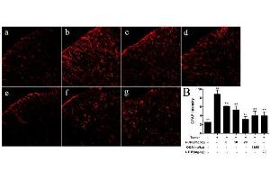 Formalin-fixed and paraffin embedded mouse spinal cord stained with GFAP Polyclonal Antibody  at 1:100 dilution.
