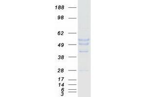 Validation with Western Blot