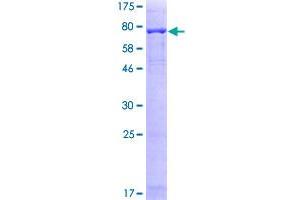 Image no. 1 for Preferentially Expressed Antigen in Melanoma (PRAME) (AA 1-509) protein (GST tag) (ABIN1316123)