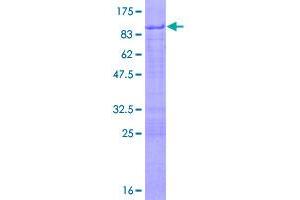 Image no. 1 for PHD Finger Protein 23 (PHF23) (AA 1-403) protein (GST tag) (ABIN1314896)
