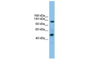 POLR1B antibody used at 1 ug/ml to detect target protein. (POLR1B anticorps)