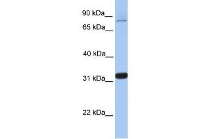 TIPIN antibody used at 0. (TIPIN anticorps  (Middle Region))