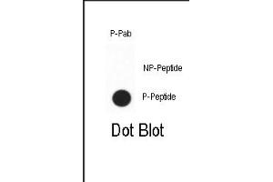 Dot blot analysis of anti-Phospho-CDX2 Phospho-specific Pab (ABIN650838 and ABIN2839803)? (CDX2 anticorps  (pSer283))