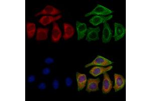 ABIN6258248 and ABIN6273391 staining Hela cells by IF/ICC.