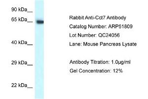 Western Blotting (WB) image for anti-Chaperonin Containing TCP1, Subunit 7 (Eta) (CCT7) (C-Term) antibody (ABIN2784637) (CCT7 anticorps  (C-Term))
