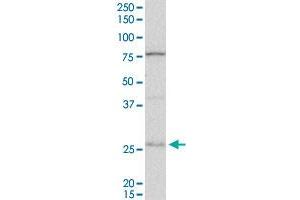 DNAJB6 polyclonal antibody (A01).