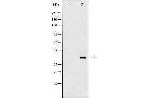 Western blot analysis of 14-3-3 zeta/ delta phosphorylation expression in UV treated Jurkat whole cell lysates,The lane on the left is treated with the antigen-specific peptide. (14-3-3 zeta anticorps  (pThr232))