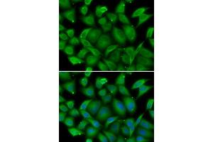 Immunofluorescence analysis of HeLa cells using DEFA1 antibody (ABIN5974152). (alpha Defensin 1 anticorps)