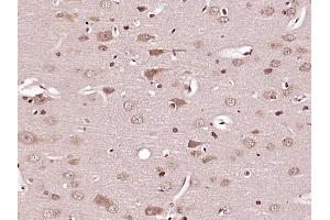 Paraformaldehyde-fixed, paraffin embedded Rat brain Antigen retrieval by boiling in sodium citrate buffer (pH6.