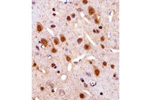 Immunohistochemical analysis of paraffin-embedded R.