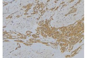 ABIN6272872 at 1/100 staining Human lung tissue by IHC-P.