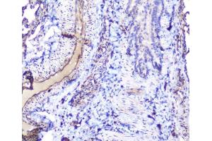 IHC analysis of INPPL1 using anti-INPPL1 antibody (ABIN6719492).