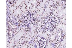 ABIN6267312 at 1/200 staining human kidney tissue sections by IHC-P.