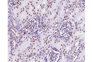 ABIN6267312 at 1/200 staining human kidney tissue sections by IHC-P.