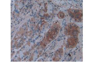 IHC-P analysis of Human Stomach Tissue, with DAB staining. (IL1A anticorps  (AA 113-271))