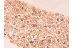 Detection of PAH in Human Liver Tissue using Polyclonal Antibody to Phenylalanine Hydroxylase (PAH)
