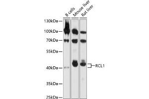 Western blot analysis of extracts of various cell lines, using RCL1 antibody  at 1:1000 dilution. (RCL1 anticorps  (AA 1-300))