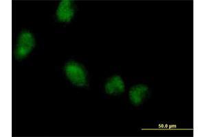 Immunofluorescence of purified MaxPab antibody to LMCD1 on HeLa cell. (LMCD1 anticorps  (AA 1-365))