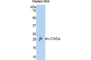 Detection of Recombinant CFP, Mouse using Polyclonal Antibody to Complement Factor P (CFP) (CFP anticorps  (AA 310-459))