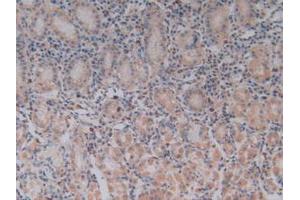 IHC-P analysis of Human Stomach Tissue, with DAB staining. (TLR9 anticorps  (AA 28-362))