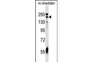 ADCY9 Antibody (C-term) (ABIN1536696 and ABIN2849404) western blot analysis in mouse bladder tissue lysates (35 μg/lane). (ADCY9 anticorps  (C-Term))