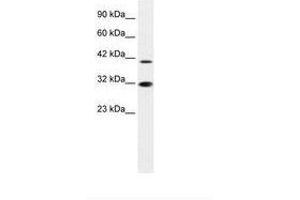 Image no. 1 for anti-Interferon Regulatory Factor 2 (IRF2) (AA 52-101) antibody (ABIN6735872) (IRF2 anticorps  (AA 52-101))