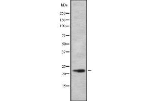 Western blot analysis of DRD1IP using RAW264. (CALY anticorps  (Internal Region))