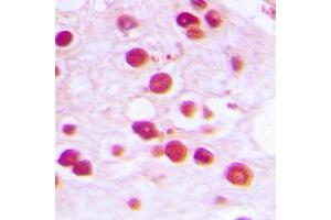 anti-Zinc Finger Protein 232 (ZNF232) (Center) antibody