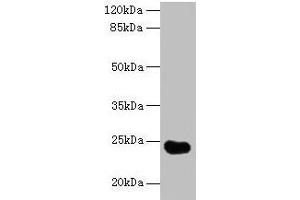 Western blot All lanes: GGTLC2 antibody at 2 μg/mL + Mouse kidney tissue Secondary Goat polyclonal to rabbit IgG at 1/10000 dilution Predicted band size: 24 kDa Observed band size: 24 kDa (GGTLC2 anticorps  (AA 1-218))