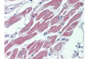 Human Heart: Formalin-Fixed, Paraffin-Embedded (FFPE) (STK39 anticorps  (C-Term))