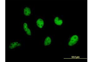 Immunofluorescence of purified MaxPab antibody to EP400 on HeLa cell. (EP400 anticorps  (AA 1-985))