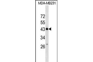 ZN Antibody (N-term) (ABIN1539540 and ABIN2849490) western blot analysis in MDA-M cell line lysates (35 μg/lane). (ZNF550 anticorps  (N-Term))