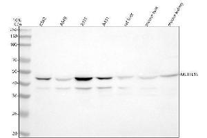 Western blot analysis of METT5D1/METTL15 using anti-METT5D1/METTL15 antibody (ABIN7600565).