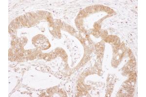 Immunohistochemistry (IHC) image for anti-Caspase 3 (CASP3) (AA 1-50) antibody (ABIN7454937)