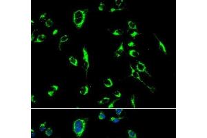 Immunofluorescence analysis of MCF-7 cells using APOBEC3G Polyclonal Antibody