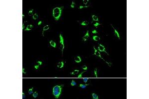Immunofluorescence analysis of MCF-7 cells using APOBEC3G Polyclonal Antibody (APOBEC3G anticorps)