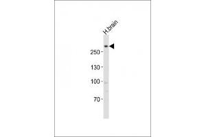 Western blot testing of LRRK2 antibody at 1:1000 dilution + human brain lysate