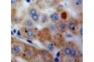 Used in DAB staining on fromalin fixed paraffin-embedded Liver tissue (CSTA anticorps  (AA 1-98))