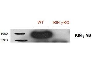 Western Blotting (WB) image for anti-SNF1-Related Protein Kinase Regulatory Subunit gamma 1 (KING1) (Regulatory Subunit Gamma) antibody (ABIN5326729) (KING1 anticorps  (Regulatory Subunit Gamma))