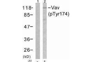 Image no. 1 for anti-Vav 1 Oncogene (VAV1) (pTyr174) antibody (ABIN196856) (VAV1 anticorps  (pTyr174))