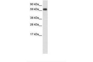 Image no. 1 for anti-T-Bet (AA 36-85) antibody (ABIN202727) (T-Bet anticorps  (AA 36-85))