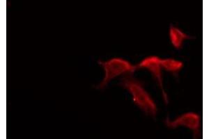 anti-Melatonin Receptor 1B (MTNR1B) (N-Term) antibody