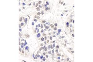 Immunohistochemistry (IHC) image for anti-DNA Cross-Link Repair 1C (DCLRE1C) (C-Term) antibody (ABIN7454515) (DCLRE1C anticorps  (C-Term))