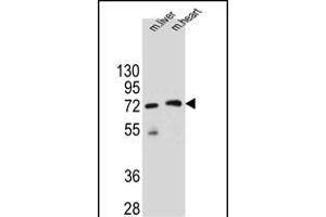 KCTD8 Antibody (C-term) (ABIN655546 and ABIN2845055) western blot analysis in mouse liver and heart tissue lysates (35 μg/lane). (KCTD8 anticorps  (C-Term))